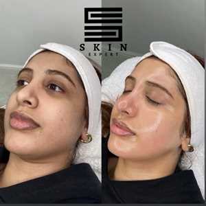 SKIN EXPERT, un professionnel de l'épilation à Villeneuve-d'Ascq